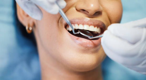 Best Emergency Dental Services for Seniors in Cherry Valley, IL